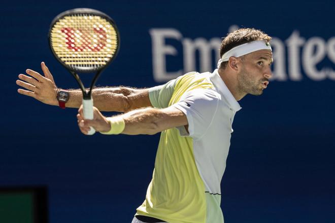 买断条款等 买断条款等